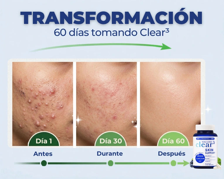 CLEAR 3 SKIN SUPPORT